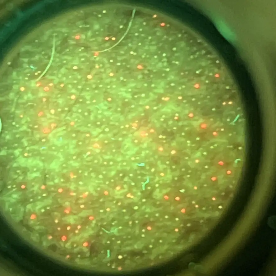 Mapeamento fluorescente do couro cabeludo — imagem 2